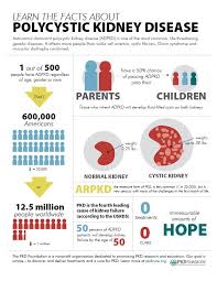 Facts About Pkd Pkd Polycystic Kidney Disease Kidney