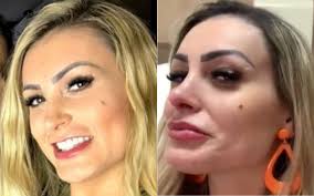 Her birthday, what she did before fame, her family life, fun trivia facts, popularity rankings, and more. Andressa Urach Performs A New Aesthetic Procedure On Her Face And Snubs Rich Face Entertainment Prime Time Zone
