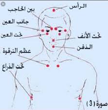 تقنية العلاج بالنقر emotional freedom technique emotional freedom technique eft emotional freedom