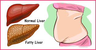 Maybe you would like to learn more about one of these? 5 Best Yoga Asanas For A Healthy Liver A Step By Step Tutorial