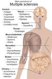 This damage disrupts the ability of parts of the nervous system to transmit signals , resulting in a range of signs and symptoms , including physical, mental. Multiple Sclerosis Wikipedia