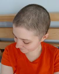 Different treatments can cause very different types and amounts of hair loss (which doctors call alopecia). My Hair Growth After Chemo Griffblog Uk Fashion Lifestyle