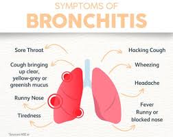 Image result for Acute Bronchitis