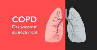 Copd 13 Nicht Alltagliche Fakten Die Du Wissen Solltest