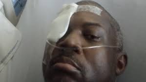 CO injured during unrest at Ga. prison remains hospitalized