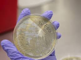 Oxoid, basingstoke, united kingdom), a new selective chromogenic medium, was compared to dcls agar (oxoid) for the detection and presumptive identification of salmonella species from stool samples. Development Of A More Sensitive And Specific Chromogenic Agar Medium For The Detection Of Vibrio Parahaemolyticus And Other Vibrio Species Protocol