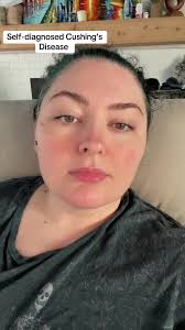 Shandy Smith Cushing