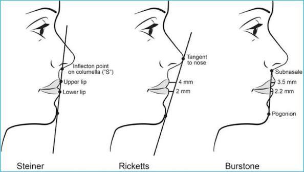 Journal of Aesthetic Nursing - Focusing on chin augmentation: treating the  lower face using dermal filler - Journal of Aesthetic Nursing