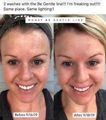 ✨ Some before and afters! Our skincare is proven to give results in just 14  days. Since its naturally based, you won't get the side effects of harsh  chemicals whichtake only 26