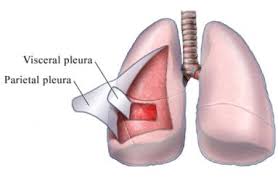 Pleurisy Mesothelioma Serous Membrane Respiratory