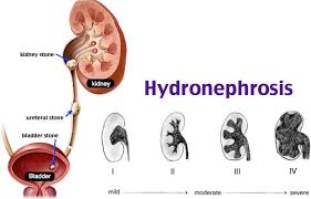 Rosh Review Diagnostic Medical Sonography Renal Medical