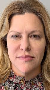 📣📣📣 Please join us in welcoming our newest Nurse Practitioner injector, Heather  Cordle, DNP. We are beyond thrilled and excited to have her join our team  and we know you will all