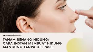 √TANAM BENANG HIDUNG: CARA INSTAN MEMBUAT HIDUNG MANCUNG TANPA OPERASI!