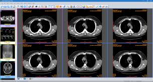 Everything works locally, nothing is uploaded to any server. Top 15 Free Dicom Viewers