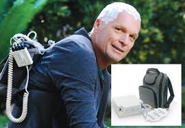 Ttfields are cytotoxic to pleural mesothelioma cells at optimal frequency of 150 khz. Months After Fda Approval Novocure Announces Brand Name For New Mesothelioma Treatment Mesothelioma Net