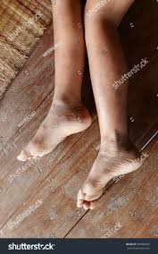 Image result for brown patches on the feet