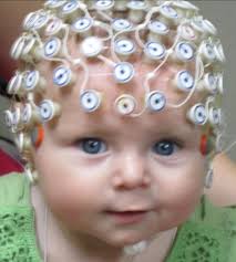 Brain changes in response to faces in the first year ICIS, 2016