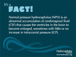 Normal Pressure Hydrocephalus Nph Is Most Commonly Seen In Older Adults Normal Pressure Brain Anatomy And Function Huntington Disease