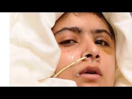 She is a human rights activist who advocates for the rights of women and girls and worldwide access to education. Malala Yousafzai 16 And Her Miraculous Story Of Surviving Being Shot By The Taliban Youtube