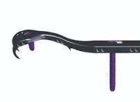 SuperCable® Grip & Plate System | Kinamed Incorporated