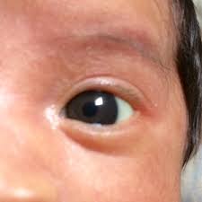 Brown and blue eye color was found to be accurately predicted 90% of the time in a study done in amsterdam. Baby S Eye Color December 2016 Babies Forums What To Expect
