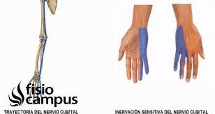 Cubital Nervio Que Es Ubicacion Donde Se Origina Recorrido Ramificaciones Que Zonas Inerva Y Lesiones