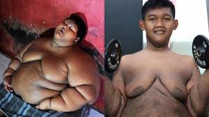 Nah, beralih dari peraturan di indonesia, ternyata 13 peraturan unik dan nggak biasa ini ada di dunia, lho! Dulu Jadi Bocah Paling Gemuk Di Dunia Seberat 192 Kilogram Kondisi Arya Permana Kini Bikin Kaget Tribun Manado