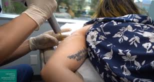Many clients referred to the program are former gang members or people coming out of the prison system, though that is not required to be eligible for this program. Laser Tattoo Removal Medical Spa San Diego Ca Clderm