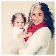 20 Hair Birthmarks So Beautiful You Ll Swear They Were Salon Made Hair Birthmark White Streak In Hair Streak In Hair