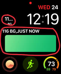 I Can T Has Cheezburger Live Ish Glucose Data On Apple Watch