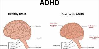 However, sometimes hair loss can a sign of something more serious going on in the body, such as also known as hypothyroidism, this is where the thyroid gland does not produce enough hormones. Treatment Uses And Side Effects Of Lisdexamfetamine Vyvanse