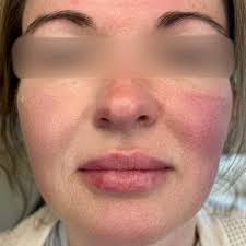 Center for Facial Rejuvenation