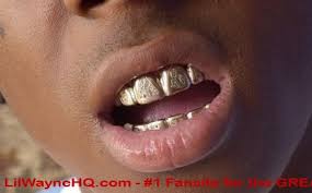 Rudd explained to mtv news on with having all of gold and diamond material in his mouth, it's going to be really difficult to get clean without knowing specific details — and lil wayne's attorney, stacy richman, declined to specify the. Lil Wayne Forum
