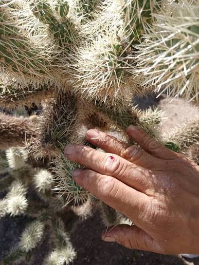 Teddy bear cholla attack experience