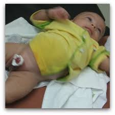 Laser circumcision is much more effective and enables the patient to heal smoothly after circumcision. Give Circumcision Inequality The Snip