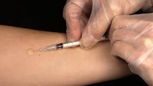 Effets secondaires vaccin grippe 2019. Coronavirus Comme Une Severe Gueule De Bois Les Effets Secondaires Du Vaccin De Pfizer Contre La Covid 19 Lindependant Fr