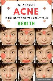 We did not find results for: Acne And Health What Your Body Is Trying To Tell You With Pimples B For Bun Bun