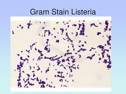 Listeria monocytogenes or just l. Ppt Listeria Powerpoint Presentation Free Download Id 4585422