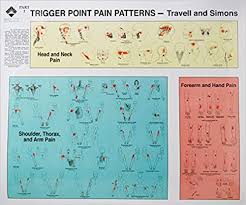 trigger points of pain wall charts set of 2