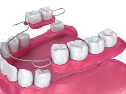 We did not find results for: Kapan Waktu Yang Tepat Untuk Mengganti Gigi Palsu