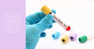 She has headaches, yeast infections, rashes, premenstrual tension, hair loss and acne. Heavy Metal Toxicity Hair Loss And Health Problems Sandra Bloom