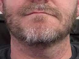 22 and can't grow a beard. When Will I Be Able To Grow A Beard Hubpages