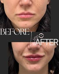 WINNERS of these amazing prizes are… Moxi Facial treatment