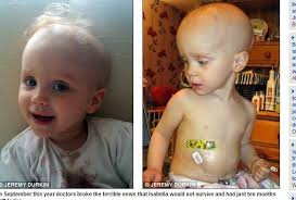 Menina de 3 anos com câncer terminal para quimioterapia para “aproveitar o  Natal”