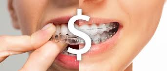 is invisalign cheaper than braces dougherty orthodontics