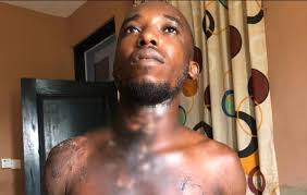 Woman bathes husband with acid at Zenu