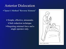 Image result for Shoulder Relocation Maneuvers