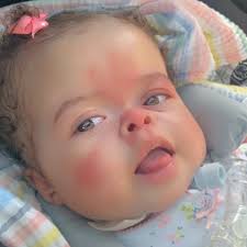 Meet Kaylee!💙 ⠀ ⠀ Kaylee is 14 months old and was born with a rare genetic  disorder known as Thanatophoric Dysplasia type 1. Her condition occurs in 1  in 50,000 newborns. Thanatophoric