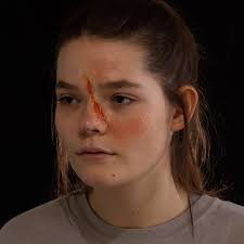 Essential Oil Chemical Burn Sfx Sfxmakeup Halloween Makeup Halloweenmakeup Makeupartist Mua Horror Makeup Humor Horror Makeup Special Effects Makeup