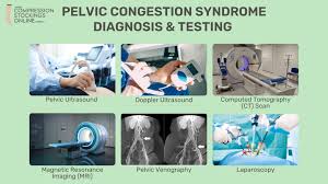 Image result for Pelvic Compression Test